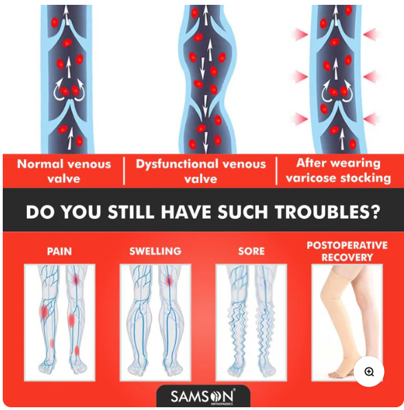 SAMSON Varicose Vein Stockings Classic (Pair) | Compression for Pain & Blood Circulation